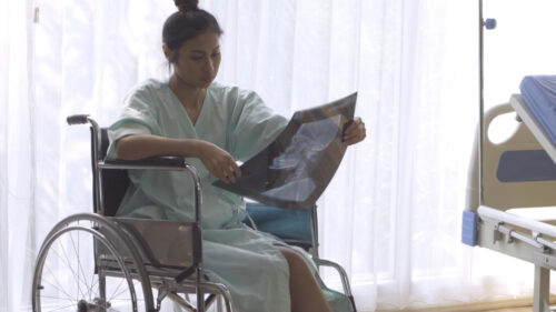 woman in wheel chair looking at her X-ray scans